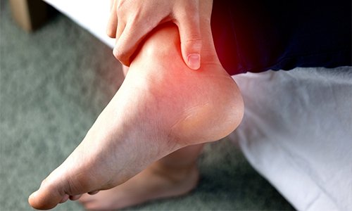 Achilles Tendinitis: Causes, Symptoms, Treatment, and Prevention - Run Doc Wellness